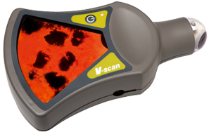 Ультразвуковой сканер «Virtual Scan»